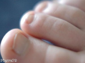 Man fined after drinking human toe