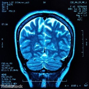 Mystery solved as missing brains are traced at last