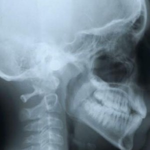 Tourist gets X-rayed on airport baggage belt