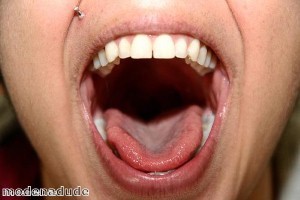 US woman ‘has massive tongue’